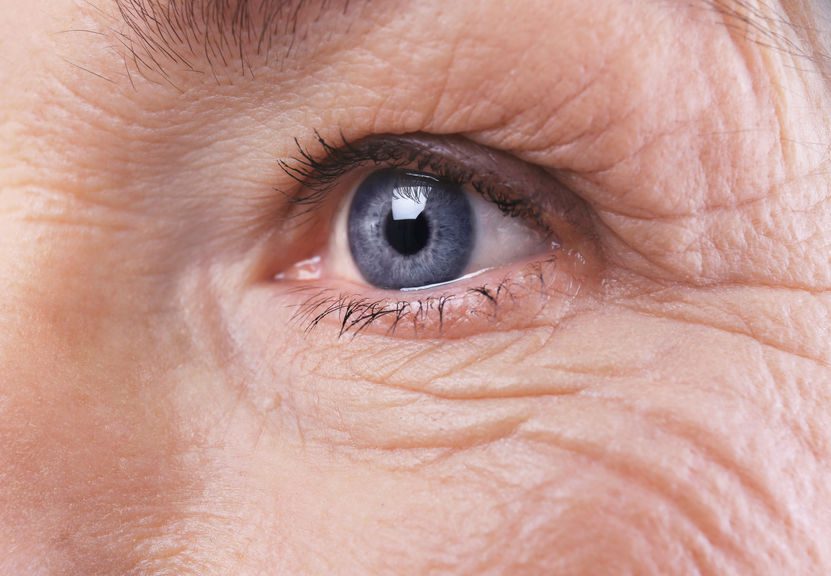cataract surgery